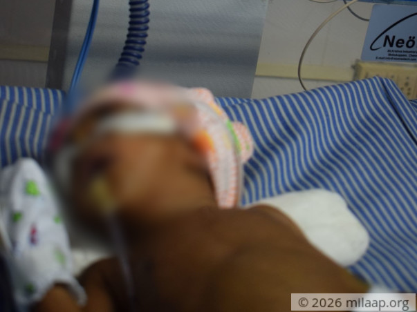 Help Kumudha's Baby Survive