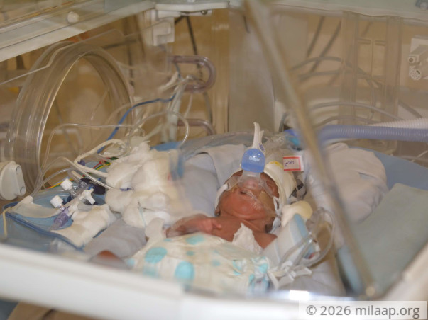 Help Baby of Mekala Survive