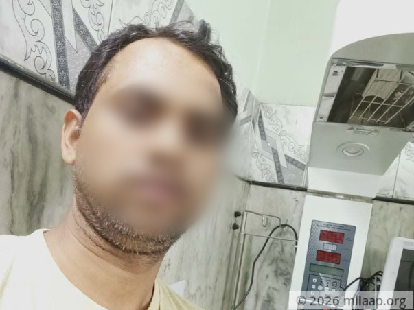 Baby of Akeel needs your help to survive