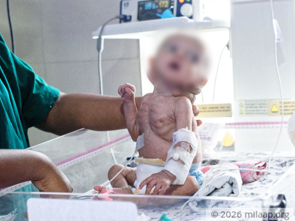 This Baby's Kidneys Will Give Up On Him Completely Without Surgery