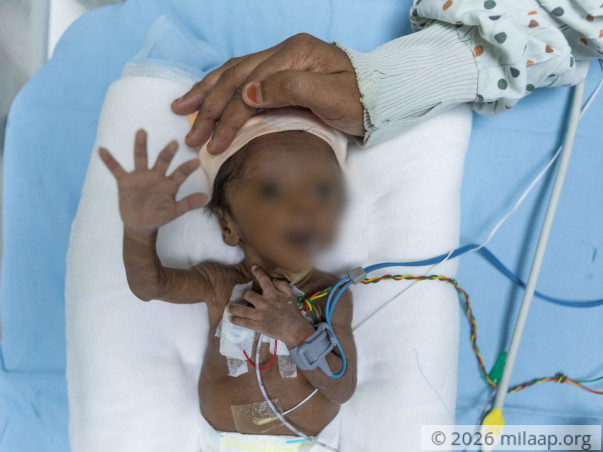 This Baby's Body Stopped Growing And He May Not Have Long To Live