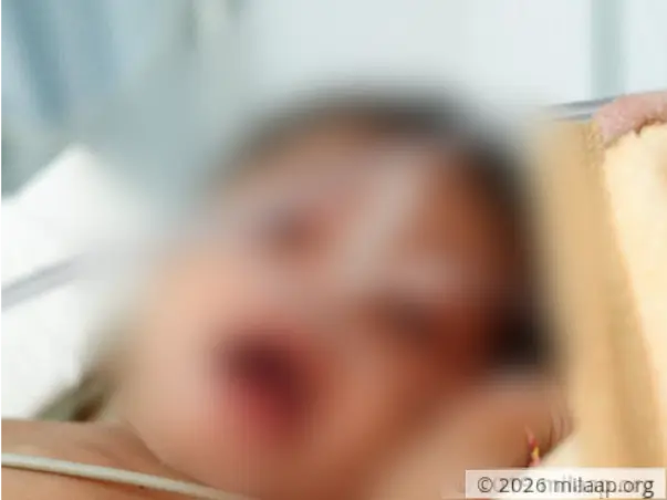 Instead Of Getting A Life-Saving Surgery, This Baby Suffers