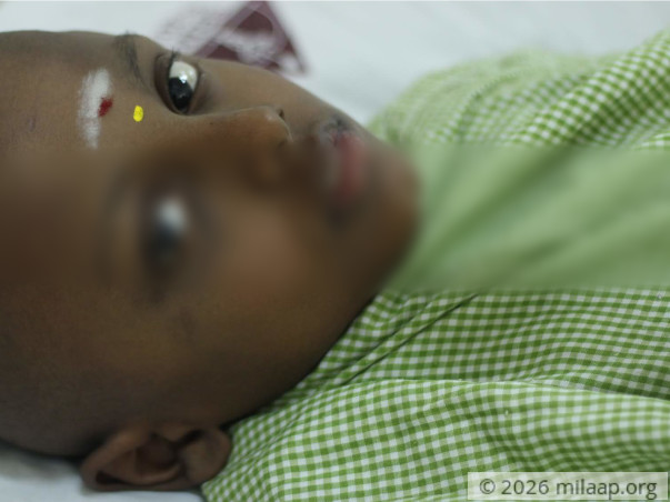 A Small Bruise On His Eye Turned Out To Be Deadly Cancer