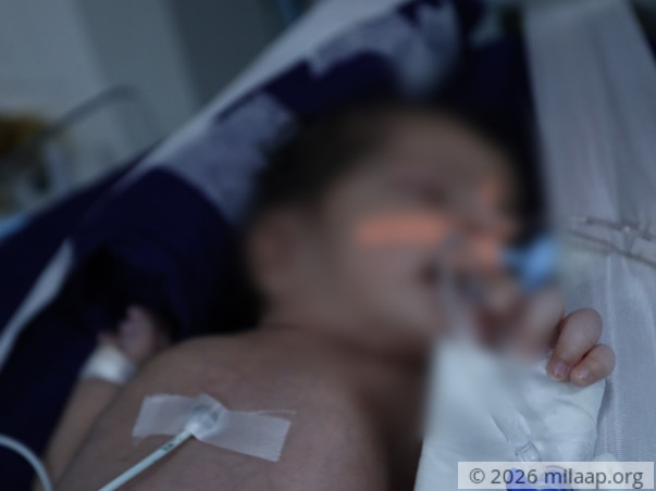 Help Ruksar's Baby Recover From Pulmonary Hemorrhage