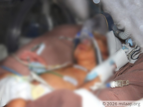 help-baby-of-jagadha-1