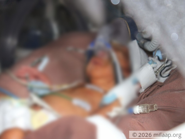 Help My Premature Babies Survive