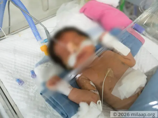 Help Swathi's Preterm Baby Survive