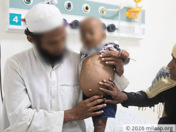 Help Baby Muzzamil Fight Chronic Liver Disease