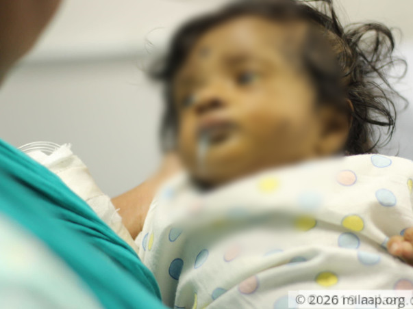 This 4-Month-Old Baby Girl Can Lose Her Life To Liver Failure