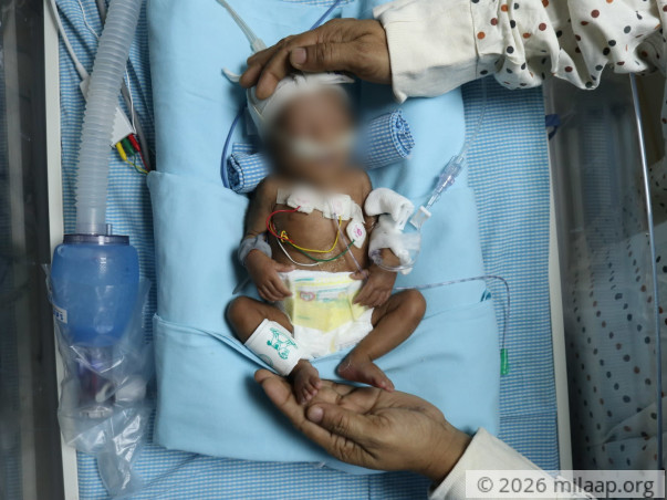 help-twins-of-varalaxmi