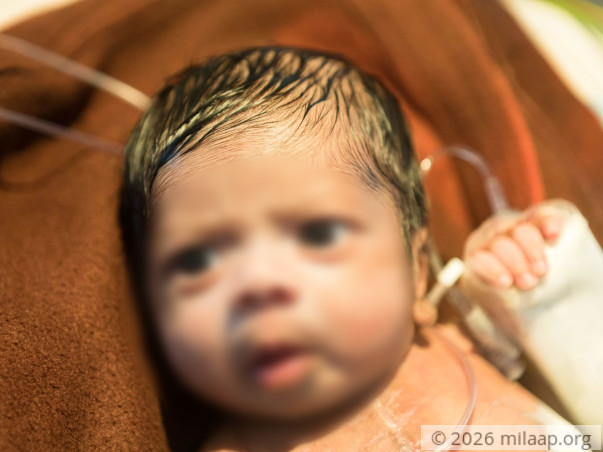 With A Scar Almost As Big As He Is, This Baby Is Struggling To Survive