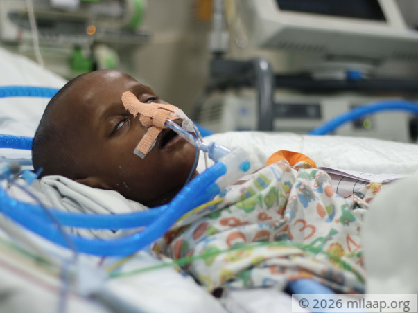 He’s Struggling To Hold On, But His Organs Are Giving Up On Him