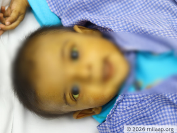 The Only Treatment That Can Save Her Life Is Beyond Her Father’s Means