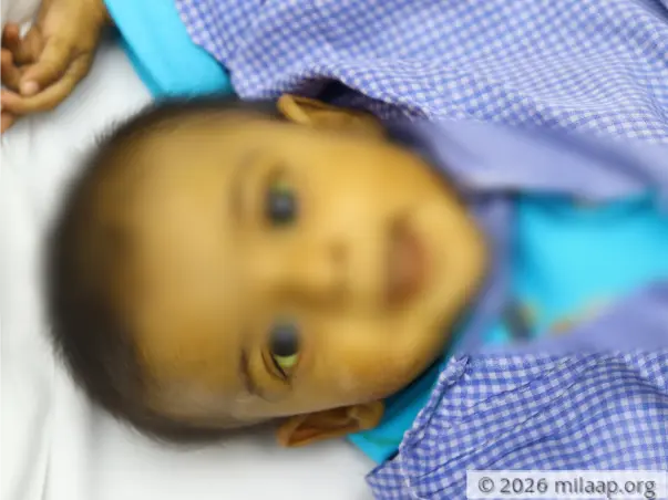 The Only Treatment That Can Save Her Life Is Beyond Her Father’s Means