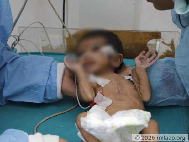 help-baby-of-laxmi-2