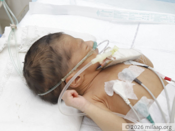 help-baby-of-shahina-1