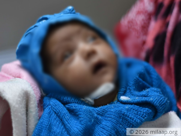 Help My Preterm Twins Survive