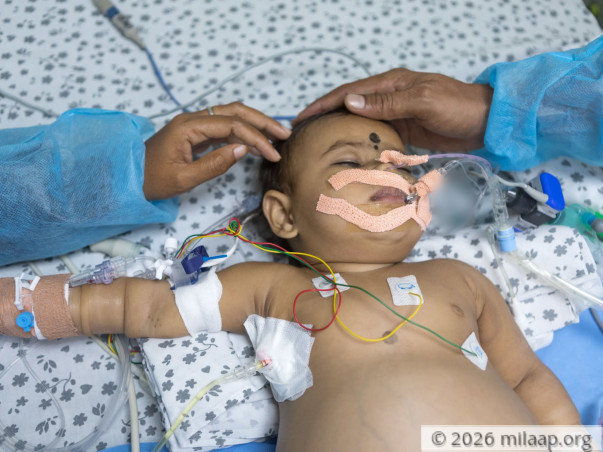 This 8-Month-Old's Stomach Is Swelling Like A Balloon