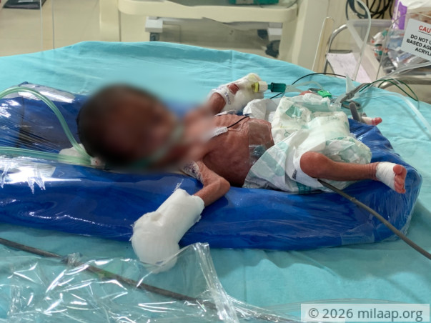 help-baby-of-sarika-1