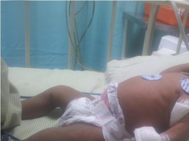 I am fundraising to save my 5 months old kid Venudev - Bone Marrow Transplantation treatment