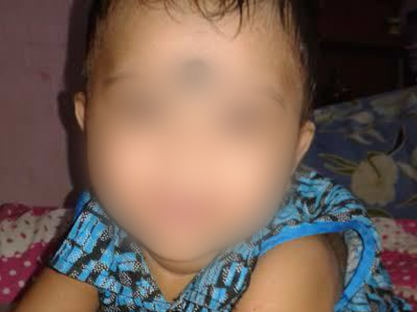 Help Baby Sourish Undergo An Emergency Open Heart Surgery