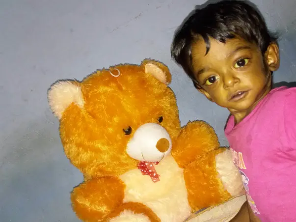 LIVER TRANSPLANTION Today (9-may-17) for  my 2yr old son Kapil Abhinav