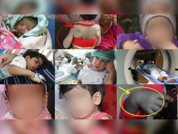 Help My Daughter Live #HelpSaveAvishi