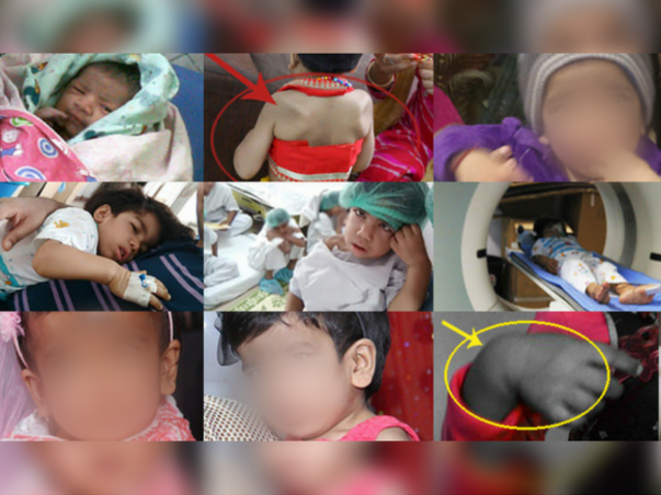 Help My Daughter Live #HelpSaveAvishi