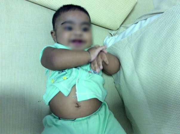 6-Month-Old Suffers From The Same Disease which Killed His Siblings