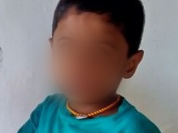 Fundraising deficit amount for Cochlear Implants for son of a widow.