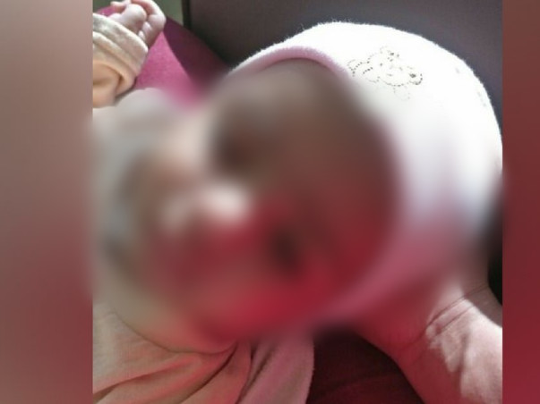 Help My 4-Month-Old Son Undergo Bone Marrow Transplant