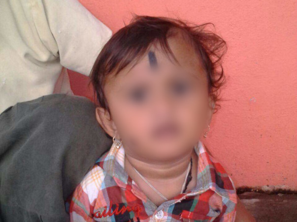 Help Baby Nuthan Undergo Cochlear Transplant