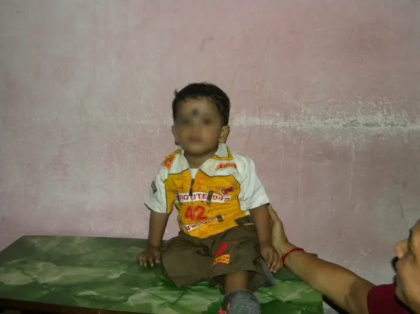 Help Baby Debrup Undergo Bone Marrow Transplant