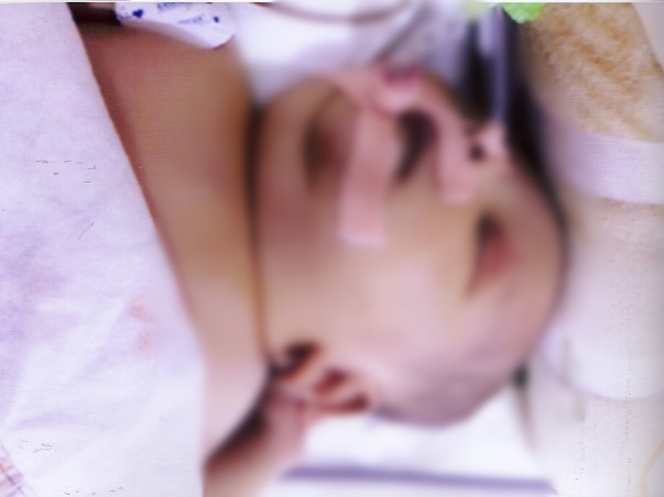 Help baby of Ramya get treatment for Sepsis