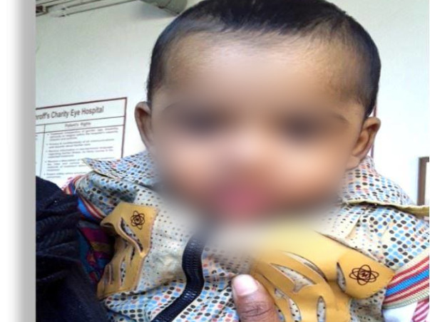 Donate to save Mehtab from retinoblastoma (cancer of eye)