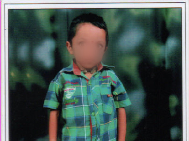 Help Durga Malleshwar Rao to fight Liver problem