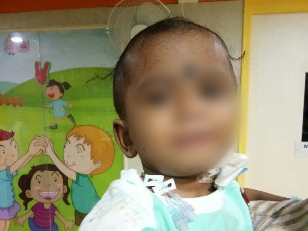 Help baby Likitesh undergo a liver transplant