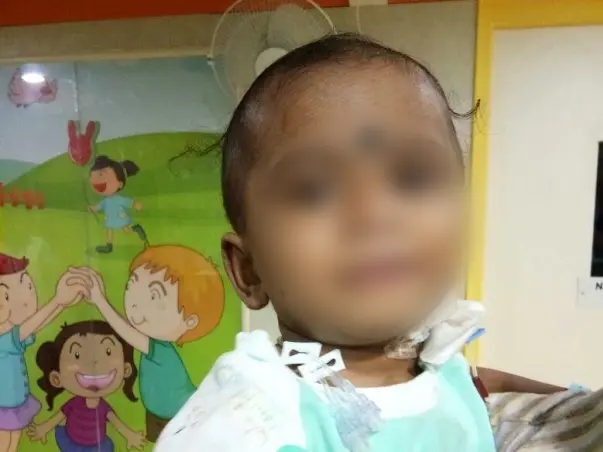 Help baby Likitesh undergo a liver transplant