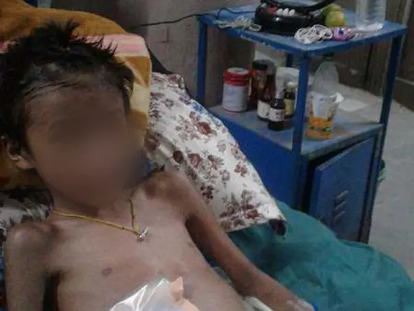 Help this 8 year old brave boy from losing his leg to gangrene