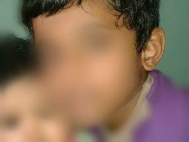 Help Mithilesh for Liver Transplant