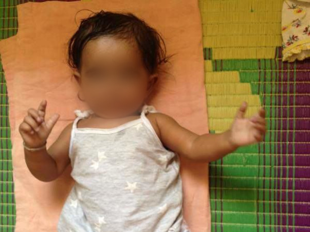 Fund Raising For Congenital Heart Surgery Of Child