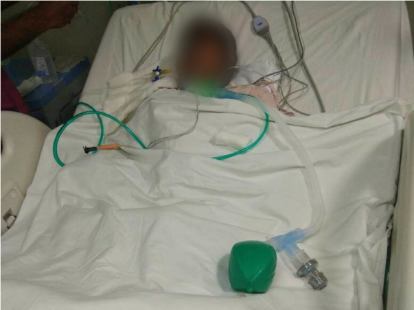 SAVE BABY KAYALVIZHI FROM CANCER  !