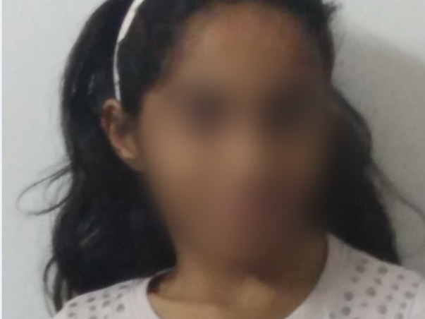 Help vanshika lead a normal life by funding her surgery