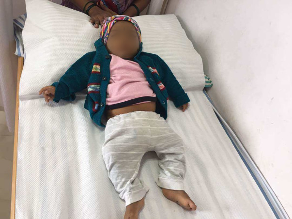 Benakashree Will Not Survive If She Does Not Get A Liver Transplant