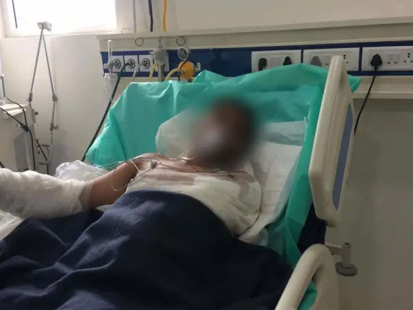 Help Cavin Recover From Burns & An Amputation Caused By Faulty Wiring