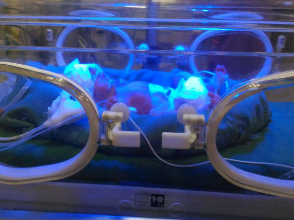 This New-Born Is Fighting Infections And Need Your Help To Stay Alive