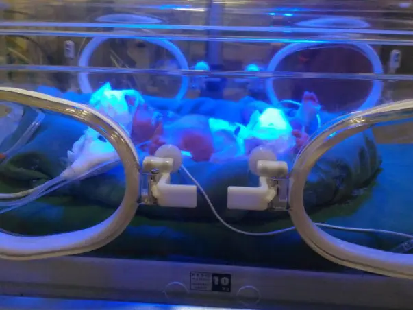 This New-Born Is Fighting Infections And Need Your Help To Stay Alive