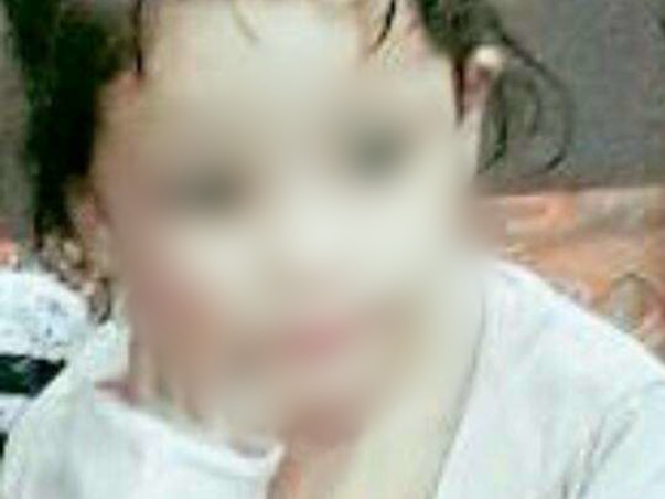 4-Year-Old Who Sweats Blood All Over Her Body Needs Urgent Help