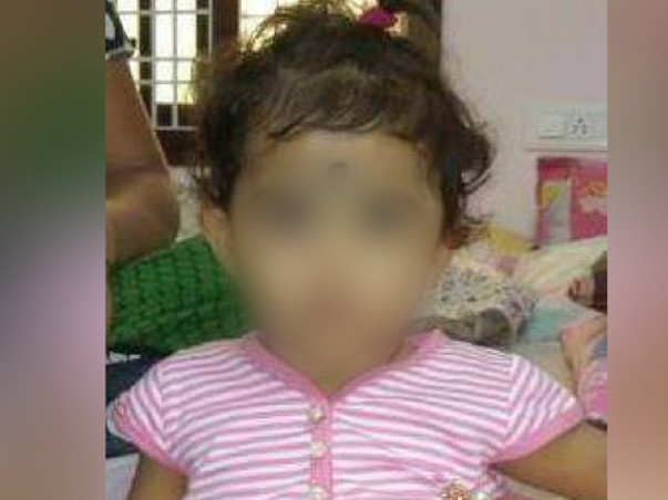 Help 1yr old baby Sadhana from severe profound hearing loss
