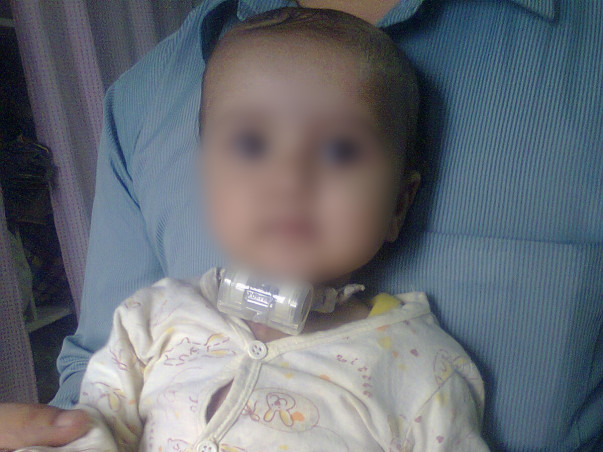 'Help Jathin fighting with major breathing problem'